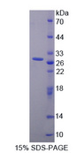 PRLR / Prolactin Receptor Protein - Recombinant  Prolactin Receptor By SDS-PAGE