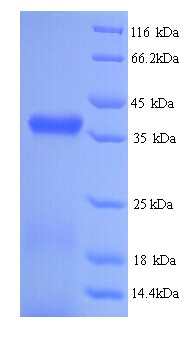 RBP3 / IRBP Protein