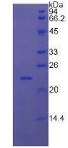 RBP4 Protein - Recombinant Retinol Binding Protein 4, Plasma By SDS-PAGE