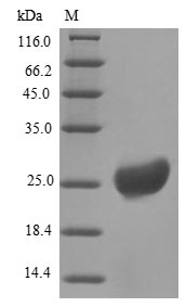 RETN / Resistin Protein - (Tris-Glycine gel) Discontinuous SDS-PAGE (reduced) with 5% enrichment gel and 15% separation gel.