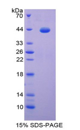 S100 Protein Protein - Recombinant S100 Calcium Binding Protein By SDS-PAGE