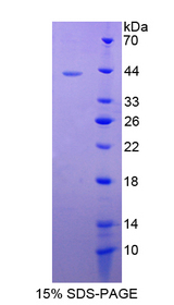 S100A2 Protein - Recombinant  S100 Calcium Binding Protein A2 By SDS-PAGE