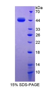 S100A7 / Psoriasin Protein - Recombinant  S100 Calcium Binding Protein A7 By SDS-PAGE
