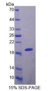 S100A8 / MRP8 Protein - Recombinant S100 Calcium Binding Protein A8 By SDS-PAGE
