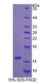 S100A9 / MRP14 Protein - Recombinant  S100 Calcium Binding Protein A9 By SDS-PAGE