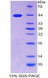 S100B / S100 Beta Protein - Recombinant S100 Calcium Binding Protein B By SDS-PAGE