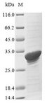SAA1 / SAA / Serum Amyloid A Protein - (Tris-Glycine gel) Discontinuous SDS-PAGE (reduced) with 5% enrichment gel and 15% separation gel.