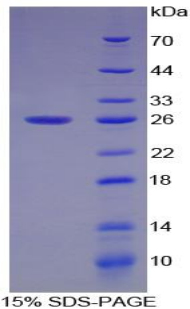 SMAD1 Protein - Recombinant Mothers Against Decapentaplegic Homolog 1 By SDS-PAGE