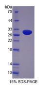 SUOX / Sulfite Oxidase Protein - Recombinant Sulfite Oxidase By SDS-PAGE