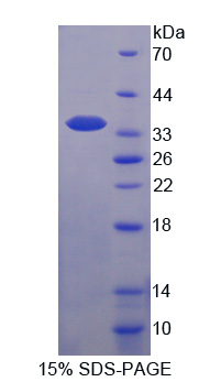 TFF3 / Trefoil Factor 3 Protein - Recombinant  Trefoil Factor 3, Intestinal By SDS-PAGE