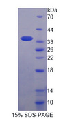 TFF3 / Trefoil Factor 3 Protein - Recombinant  Trefoil Factor 3, Intestinal By SDS-PAGE