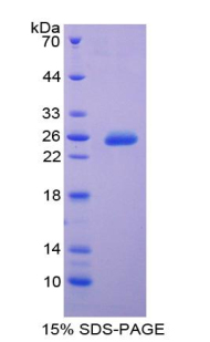 TIMP3 Protein - Recombinant Tissue Inhibitors Of Metalloproteinase 3 By SDS-PAGE