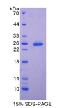 TIMP3 Protein - Recombinant Tissue Inhibitors Of Metalloproteinase 3 By SDS-PAGE