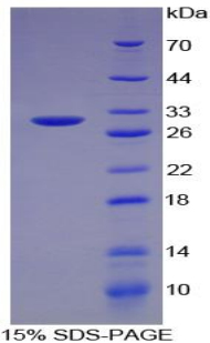 TNF Alpha Protein - Recombinant Tumor Necrosis Factor Alpha By SDS-PAGE