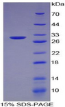 TNF Alpha Protein - Recombinant Tumor Necrosis Factor Alpha By SDS-PAGE