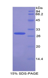 TNPO1 / Transportin 1 Protein - Recombinant Transportin 1 By SDS-PAGE