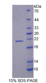 VIP Protein - Recombinant Vasoactive Intestinal Peptide By SDS-PAGE