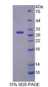 VNN1 Protein - Recombinant Vanin 1 By SDS-PAGE