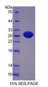 XDH / Xanthine Oxidase Protein - Recombinant Xanthine Dehydrogenase By SDS-PAGE