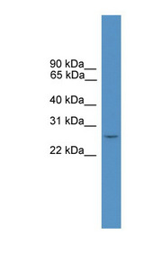 BP1 / DLX4 Antibody - DLX4 antibody Western blot of MCF7 cell lysate. This image was taken for the unconjugated form of this product. Other forms have not been tested.