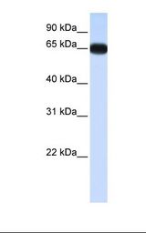 BP1 / DLX4 Antibody - Fetal lung lysate. Antibody concentration: 1.0 ug/ml. Gel concentration: 12%.  This image was taken for the unconjugated form of this product. Other forms have not been tested.