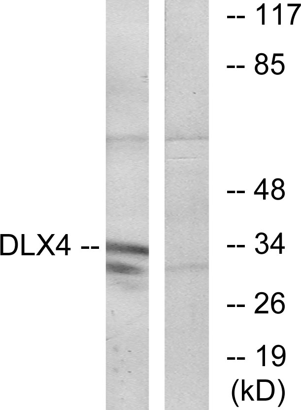 BP1 / DLX4 Antibody - Western blot analysis of lysates from COLO cells, using DLX4 Antibody. The lane on the right is blocked with the synthesized peptide.
