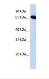 BP1 / DLX4 Antibody - HepG2 cell lysate. Antibody concentration: 1.0 ug/ml. Gel concentration: 12%.  This image was taken for the unconjugated form of this product. Other forms have not been tested.
