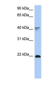 BP1 / DLX4 Antibody - DLX4 antibody Western blot of COLO205 cell lysate. This image was taken for the unconjugated form of this product. Other forms have not been tested.