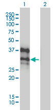 BP1 / DLX4 Antibody - Western Blot analysis of DLX4 expression in transfected 293T cell line by DLX4 monoclonal antibody (M01), clone 1F11.Lane 1: DLX4 transfected lysate(26 KDa).Lane 2: Non-transfected lysate.