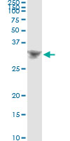 BP1 / DLX4 Antibody - Immunoprecipitation of DLX4 transfected lysate using anti-DLX4 monoclonal antibody and Protein A Magnetic Bead, and immunoblotted with DLX4 rabbit polyclonal antibody.