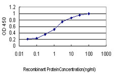 BP1 / DLX4 Antibody - Detection limit for recombinant GST tagged DLX4 is approximately 0.03 ng/ml as a capture antibody.
