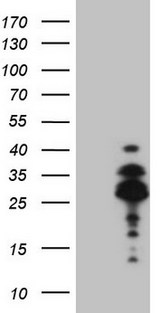 BP1 / DLX4 Antibody - HEK293T cells were transfected with the pCMV6-ENTRY control. (Left lane) or pCMV6-ENTRY DLX4. (Right lane) cDNA for 48 hrs and lysed. Equivalent amounts of cell lysates. (5 ug per lane) were separated by SDS-PAGE and immunoblotted with anti-DLX4. (1:2000)