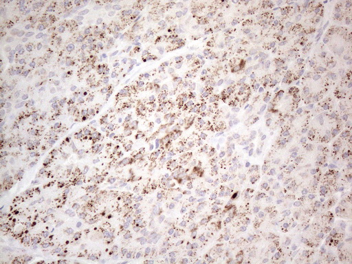 BP1 / DLX4 Antibody - Immunohistochemical staining of paraffin-embedded Human pancreas tissue within the normal limits using anti-DLX4 mouse monoclonal antibody. (Heat-induced epitope retrieval by 1mM EDTA in 10mM Tris buffer. (pH8.5) at 120°C for 3 min. (1:150)