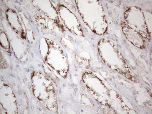 BP1 / DLX4 Antibody - Immunohistochemical staining of paraffin-embedded Human Kidney tissue within the normal limits using anti-DLX4 mouse monoclonal antibody. (Heat-induced epitope retrieval by 1mM EDTA in 10mM Tris buffer. (pH8.5) at 120°C for 3 min. (1:150)