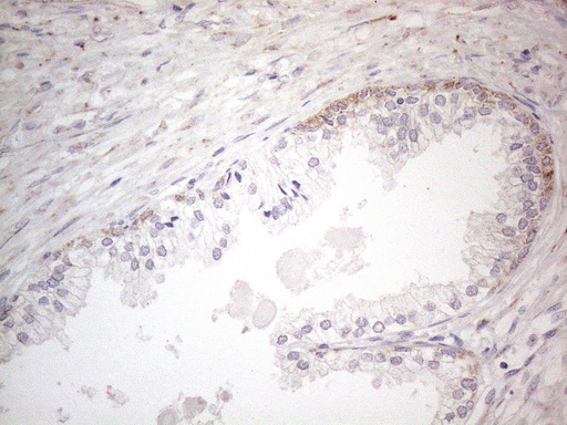 BP1 / DLX4 Antibody - Immunohistochemical staining of paraffin-embedded Human prostate tissue within the normal limits using anti-DLX4 mouse monoclonal antibody. (Heat-induced epitope retrieval by 1mM EDTA in 10mM Tris buffer. (pH8.5) at 120°C for 3 min. (1:150)