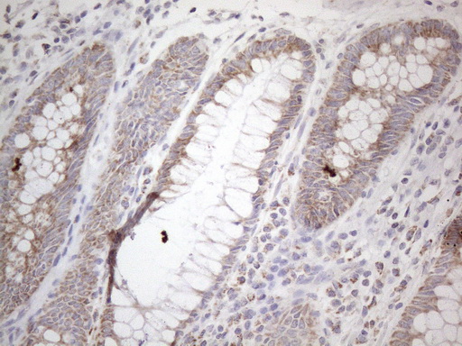 BP1 / DLX4 Antibody - Immunohistochemical staining of paraffin-embedded Human colon tissue within the normal limits using anti-DLX4 mouse monoclonal antibody. (Heat-induced epitope retrieval by 1mM EDTA in 10mM Tris buffer. (pH8.5) at 120°C for 3 min. (1:150)