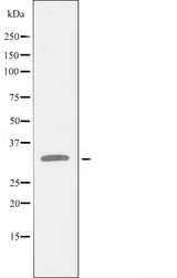 BP1 / DLX4 Antibody - Western blot analysis of extracts of COLO cells using DLX4 antibody.