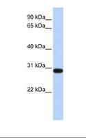 BPGM Antibody - Fetal heart lysate. Antibody concentration: 1.0 ug/ml. Gel concentration: 12%.  This image was taken for the unconjugated form of this product. Other forms have not been tested.