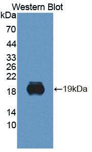 BPGM Antibody - Western Blot; Sample: Recombinant protein.
