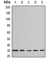 BPGM Antibody - Western blot analysis of BPGM expression in Jurkat (A); HeLa (B); mouse liver (C); mouse testis (D); rat brain (E) whole cell lysates.