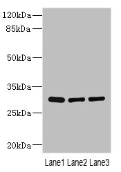 BPGM Antibody - Western blot All Lanes: BPGM antibody at 2.87ug/ml Lane 1: Human placenta tissue Lane 2: Hela whole cell lysate Lane 3: A549 whole cell lysate Goat polyclonal to Rabbit IgG at 1/10000 dilution Predicted band size: 30 kDa Observed band size: 30 kDa