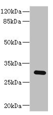 BPGM Antibody - Western blot All lanes: BPGM antibody at 2.87µg/ml + Human placenta tissue Secondary Goat polyclonal to rabbit IgG at 1/10000 dilution Predicted band size: 30 kDa Observed band size: 30 kDa