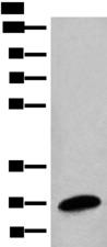 BPGM Antibody - Western blot analysis of Human placenta tissue lysate  using BPGM Polyclonal Antibody at dilution of 1:1350
