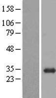 BPGM Protein - Western validation with an anti-DDK antibody * L: Control HEK293 lysate R: Over-expression lysate