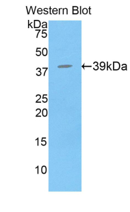BPI Antibody - Western blot of recombinant BPI.  This image was taken for the unconjugated form of this product. Other forms have not been tested.