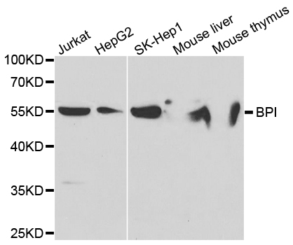 BPI Antibody - Western blot analysis of extracts of various cell lines.