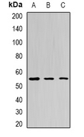 BPI Antibody - Western blot analysis of BPI expression in Jurkat (A); HepG2 (B); mouse liver (C) whole cell lysates.