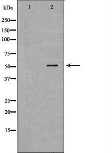 BPI Antibody - Western blot analysis of HepG2 whole cells lysates using BPI antibody. The lane on the left is treated with the antigen-specific peptide.