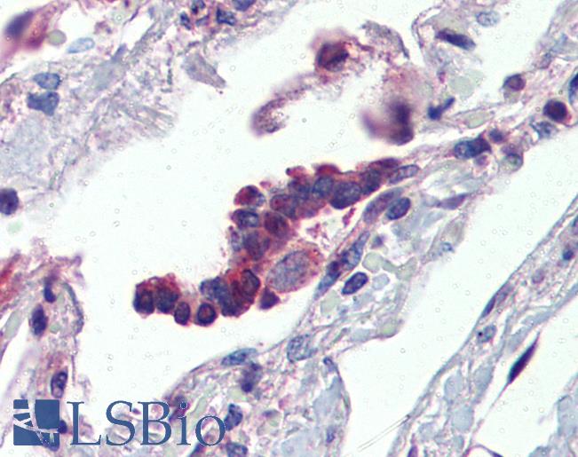 BPIFA1 / SPLUNC1 Antibody - Anti-PLUNC antibody IHC of human lung, respiratory epithelium. Immunohistochemistry of formalin-fixed, paraffin-embedded tissue after heat-induced antigen retrieval. Antibody concentration 5 ug/ml.  This image was taken for the unconjugated form of this product. Other forms have not been tested.