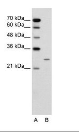 BPIFA1 / SPLUNC1 Antibody - A: Marker, B: Jurkat Cell Lysate.  This image was taken for the unconjugated form of this product. Other forms have not been tested.